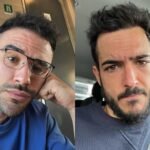 Un experto en trasplantes capilares desvela la controversia sobre IlloJuan…