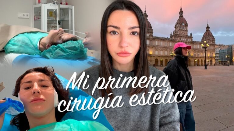 MI PRIMERA CIRUGÍA ESTÉTICA | ALEXANDRA PEREIRA